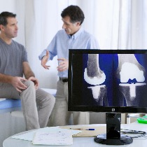 Knee Replacement
